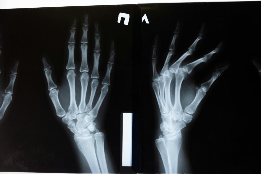 High-resolution x-ray image showing the intricate anatomy of human hands.