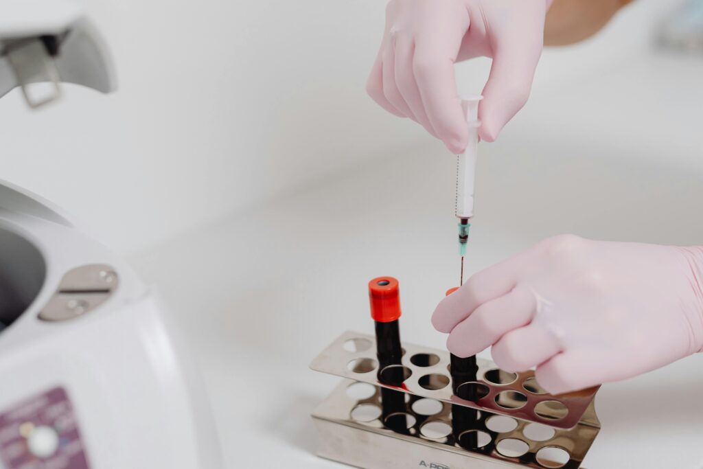 Close-up of lab technician's hands with gloves handling blood samples.